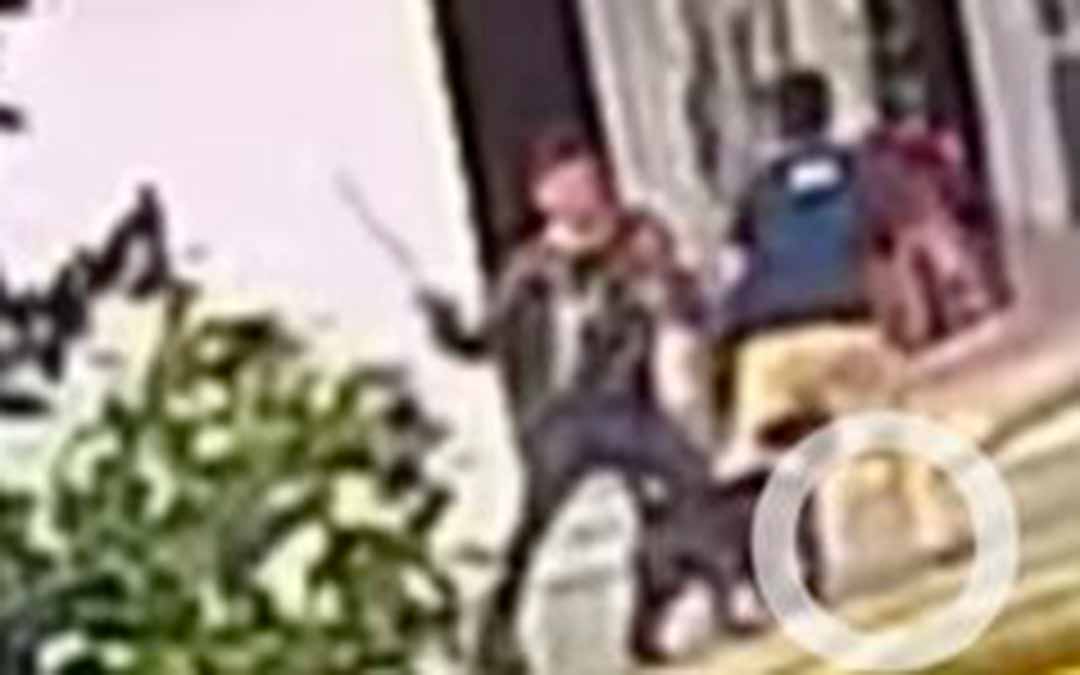 Niño atacado por perro pitbull en Circasia